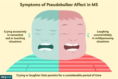 Pseudobulbar Affect and MS: Causes, Patient Information.